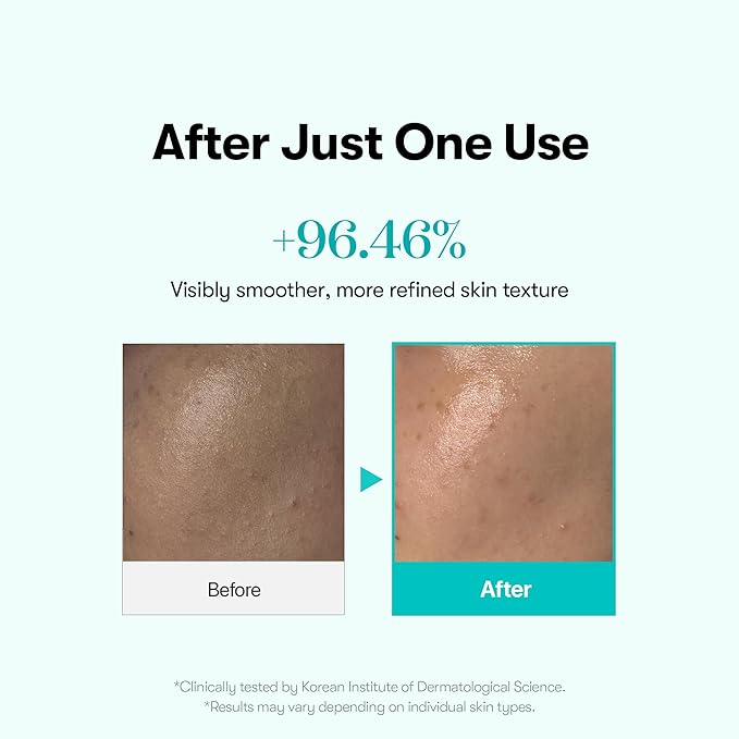 VT COSMETICS PDRN Glow Ampoule, PDRN Facial Mist, Deep Hydration Spray Serum, Vegan Skin Care, Light-weight Face Moisturizer, Plumping Effect, Fragrance-Free, Korean SkinCare (3.38 fl oz / 100 ml)