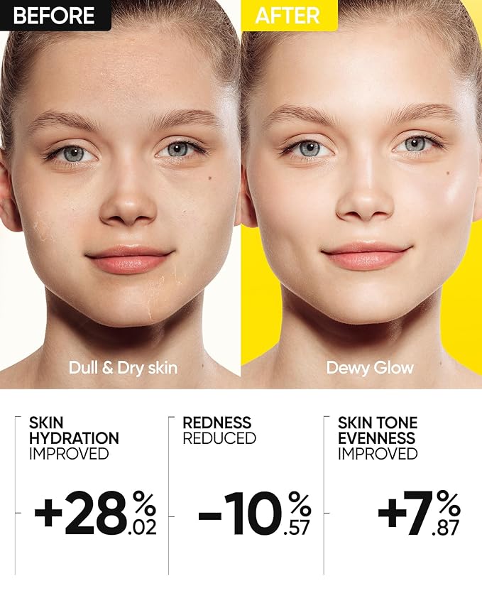 SKINTIFIC Radiance Booster Serum Spray, Hydrating Face Mist with Bifida Ferment & Squalane, Instant Dewy Glow, Soothes Skin, Vegan Skin Care, All In One Mist 3.3 fl oz